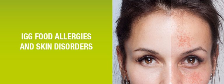Skin disorders and IgG Food Allergies
